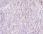 Anti-Bim BCL2L11 Rabbit Monoclonal Antibody